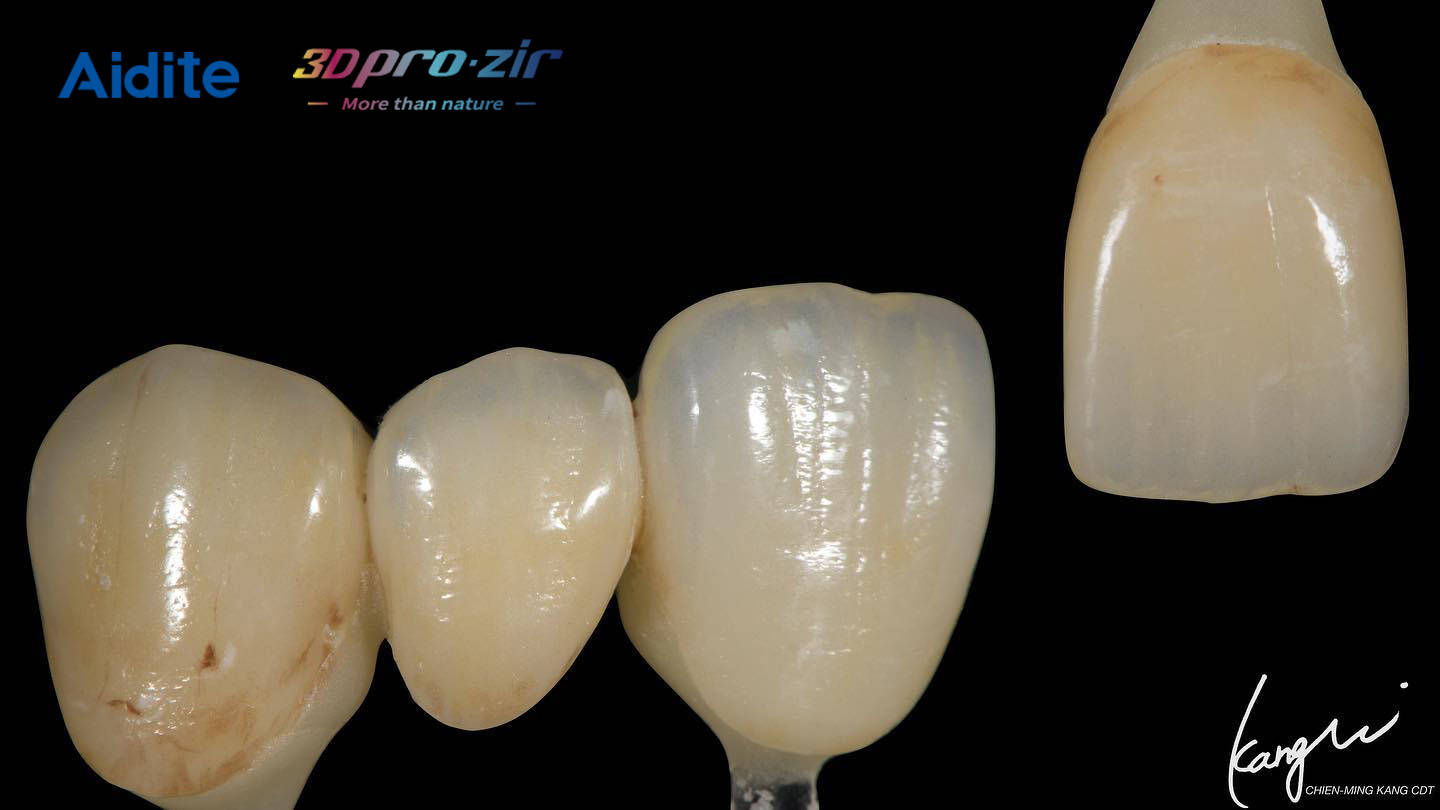 马桶蹦瓷(马桶内掉瓷如何修补) 马桶蹦瓷(马桶内掉瓷如何修补)